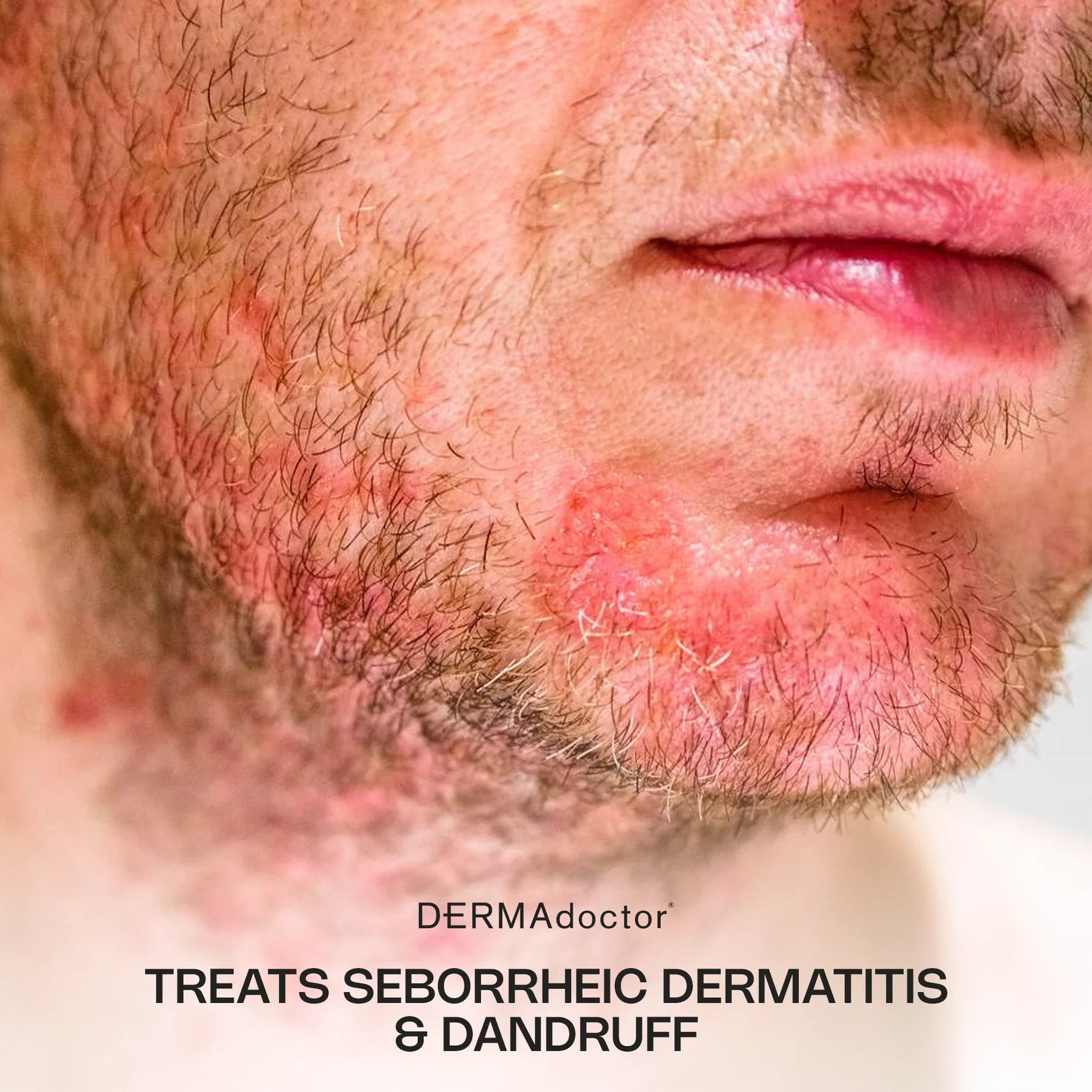 Calm Cool & Corrected Tranquility Cleanser & Cream Duo