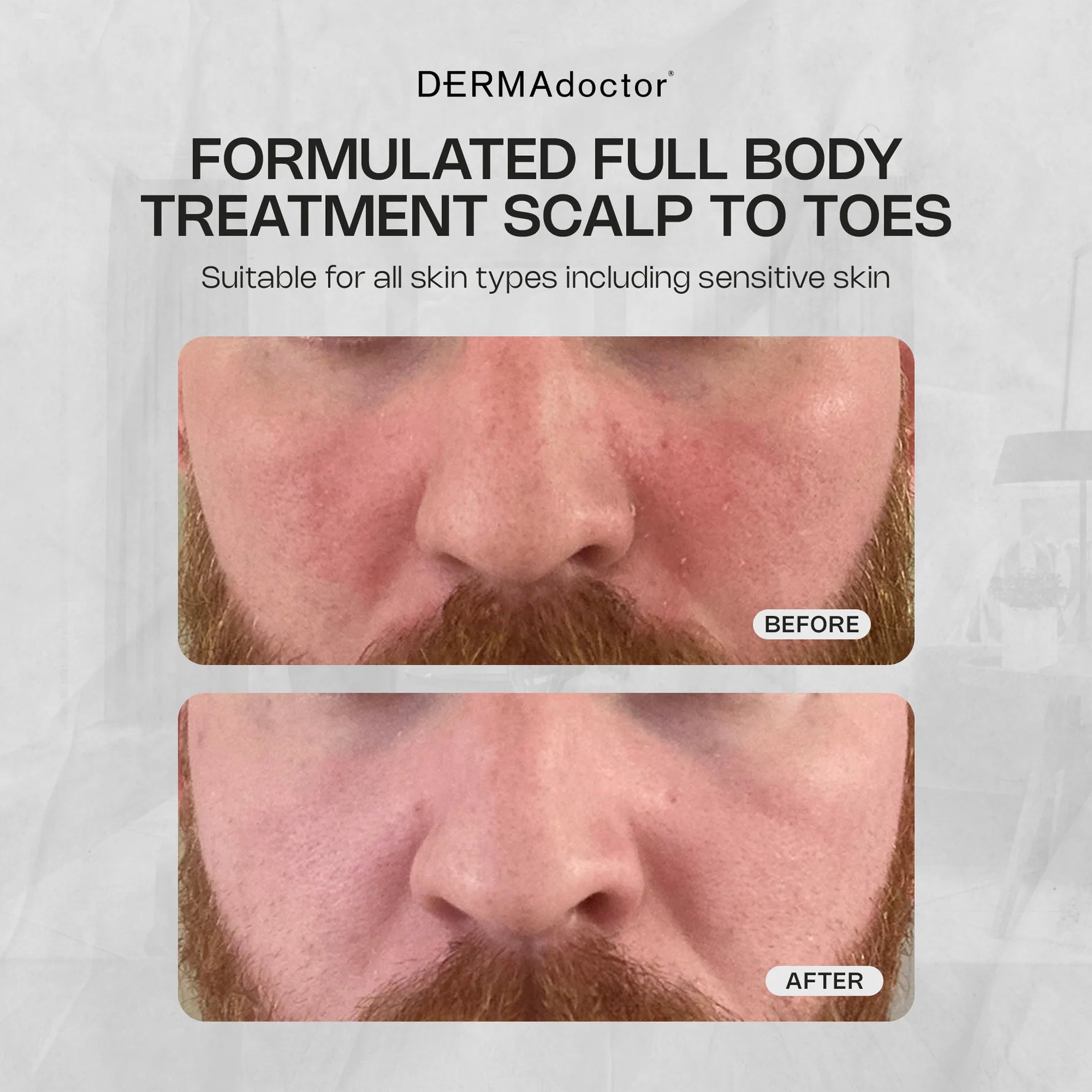 Calm Cool & Corrected Tranquility Cleanser & Cream Duo