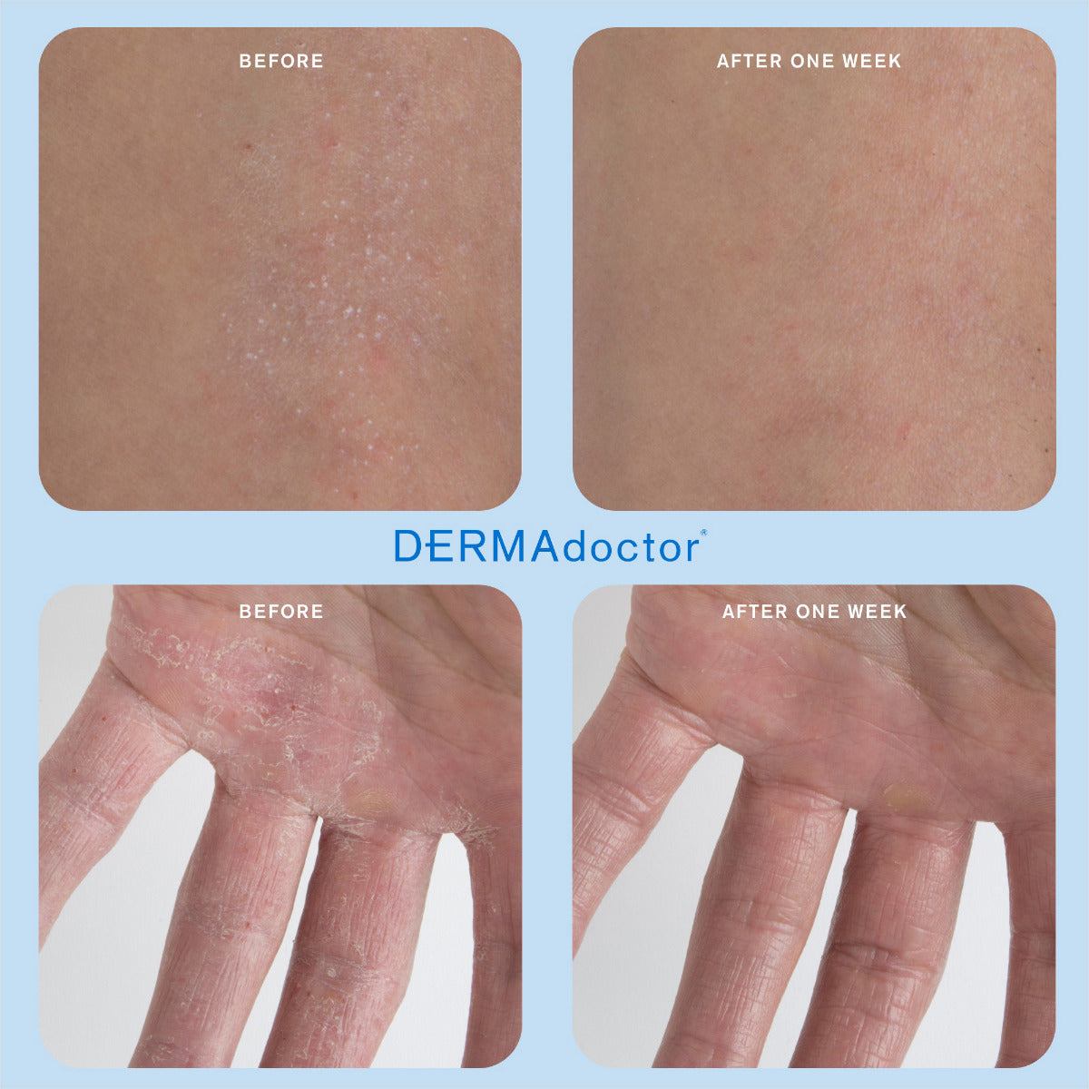 Calm Cool & Corrected Hydra Repair Cream 1% Colloidal Oatmeal, Clinical Repair Balm For Face & Body