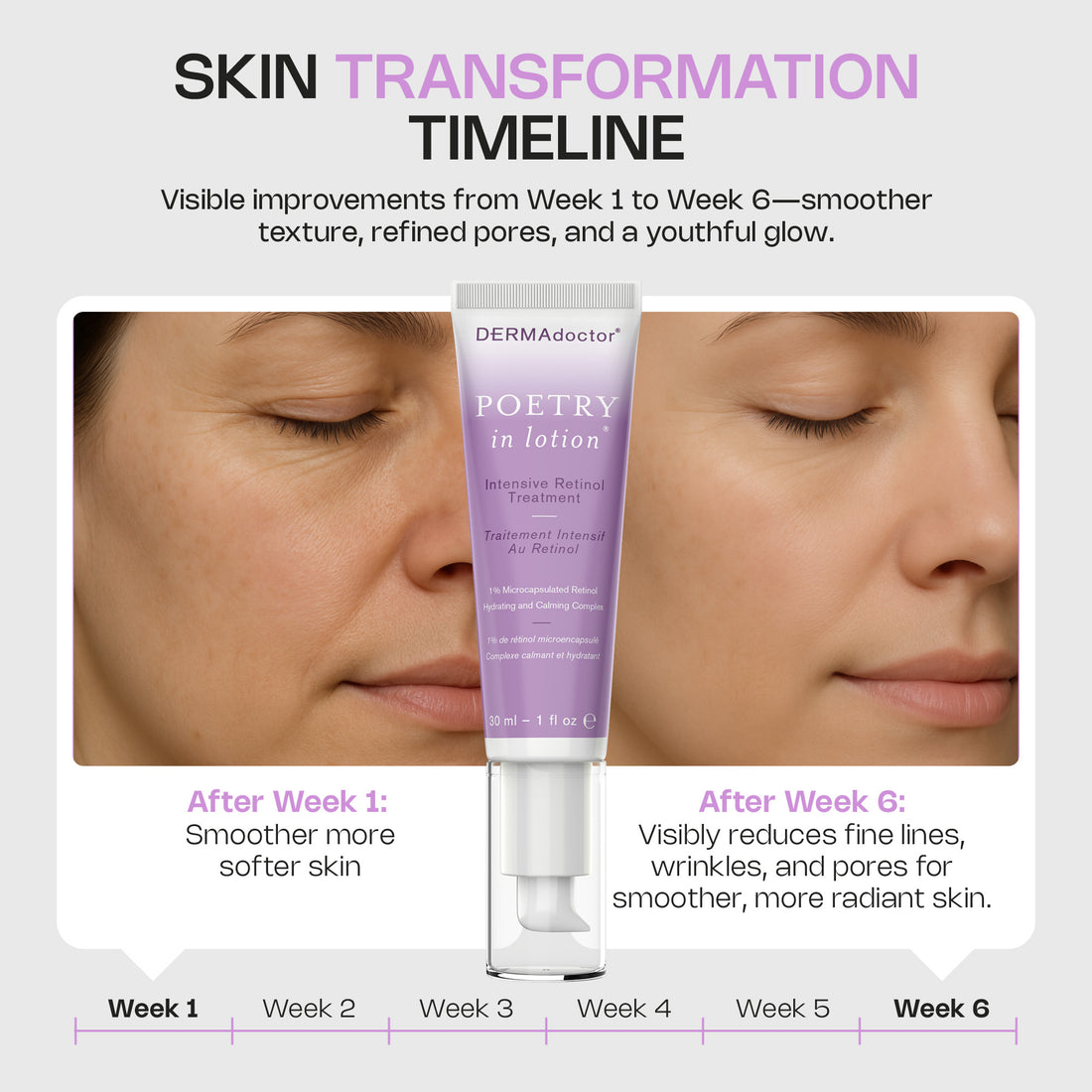 Poetry In Lotion Intensive 1% Retinol