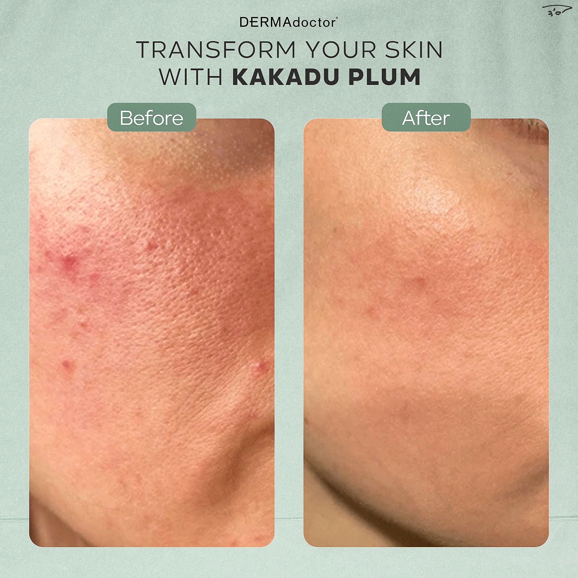 Kakadu C 20% Vitamin C Serum with Ferulic Acid &amp; Vitamin E