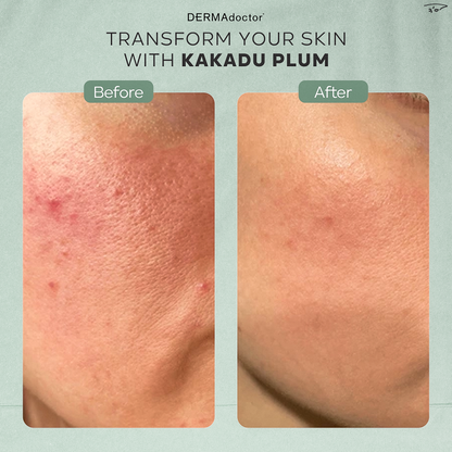 Kakadu C 20% Vitamin C Serum with Ferulic Acid &amp; Vitamin E