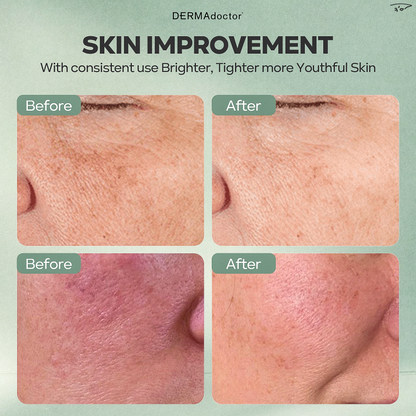 Kakadu C 20% Vitamin C Serum with Ferulic Acid &amp; Vitamin E