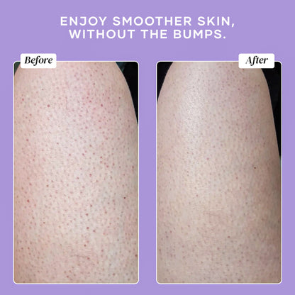 KP Duty Bump Eraser Body Scrub - Starter Size